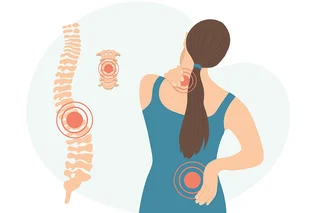 Grafische Darstellung eines Rückens mit einer Hervorhebung an der Hals- und der Lendenwirbelsäule