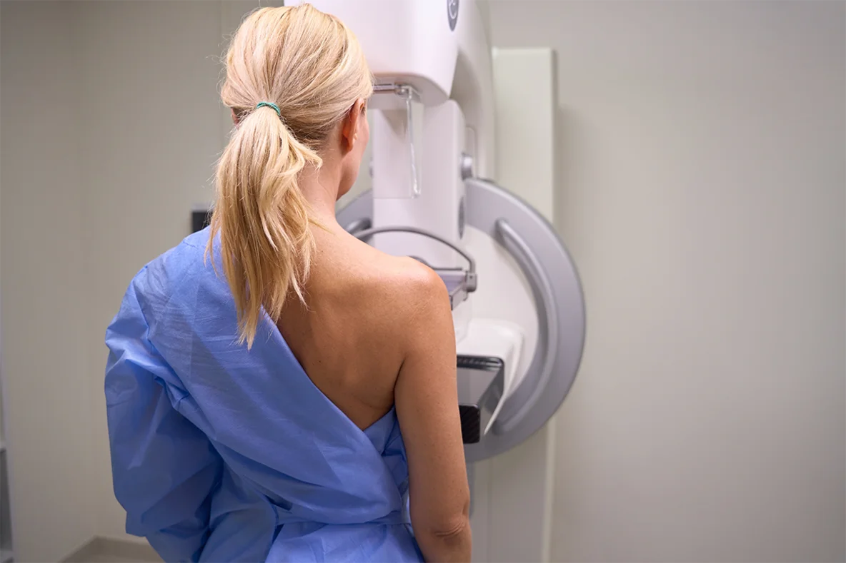 Eine weibliche Person steht an einem Mammographie-Gerät