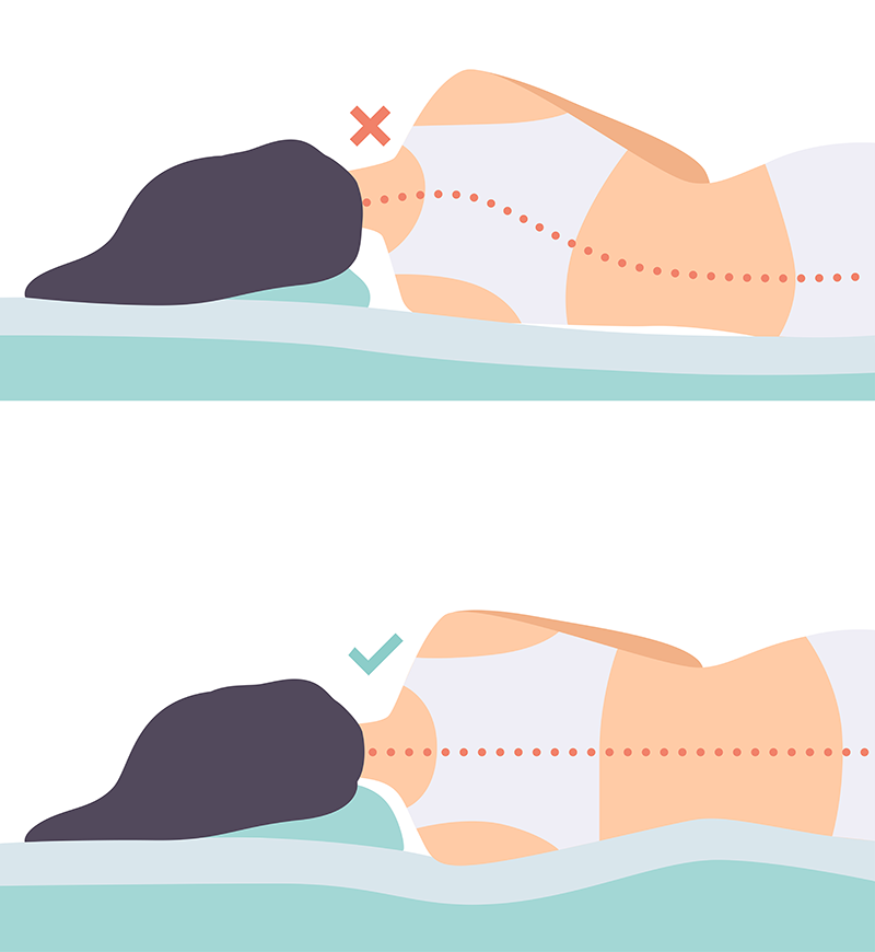 Grafische Darstellung: Vergleich korrekte Schlafposition und gekrümmte Schlafposition